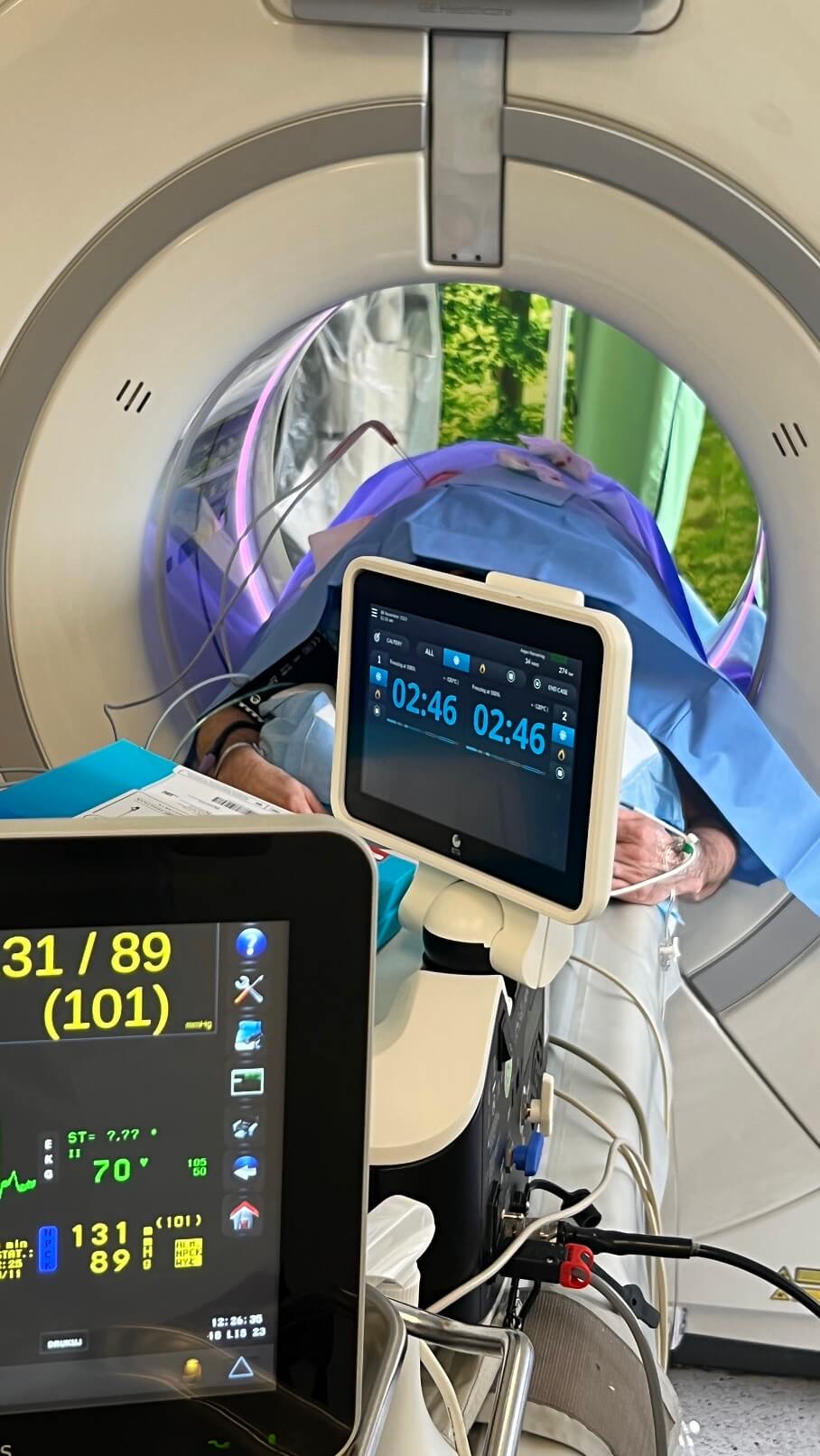 Szansa dla chorych na raka nerki. Szpital w Lublinie przeprowadził z sukcesem przełomową operację. Brawo! 5 Tomograf